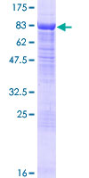 12.5% SDS-PAGE Stained with Coomassie Blue.